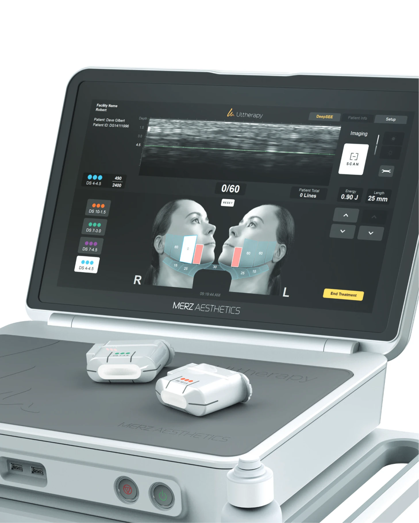 Ultherapy Prime